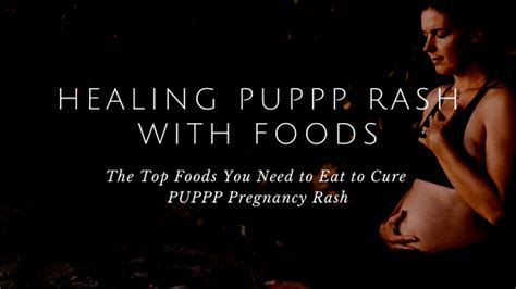 How To Heal A Puppp Pregnancy Rash With Foods Ally Boothroyd