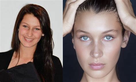 bella hadid before bella hadid s before and after surgery evolution elle judy himp1998