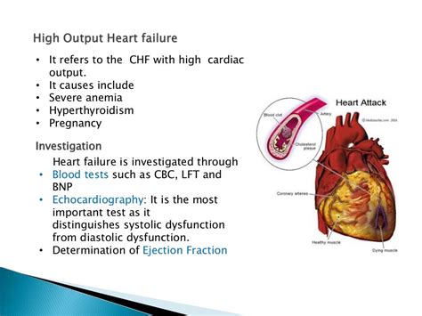 Heart Failure Presentation