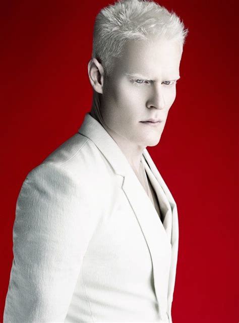 Stephen Thompson Amck Models Albino Men Albino Human Stephen Thompson