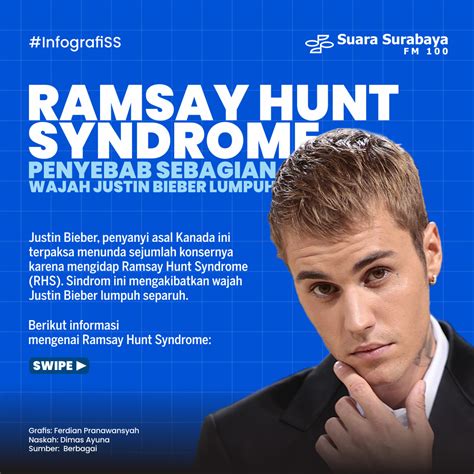 Ramsay Hunt Syndrome Penyebab Wajah Justin Bieber Lumpuh Separuh