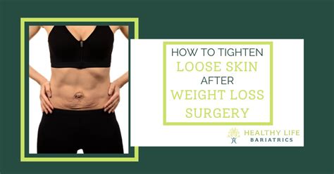 How To Tighten Loose Skin After Bariatric Surgery Los Angeles