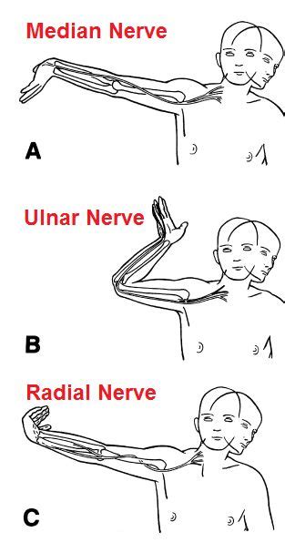 Upper Limb Tension Test Median Nerve Massage Therapy Hand Therapy