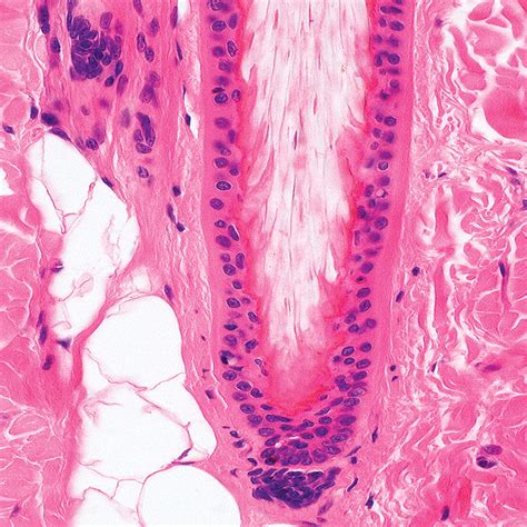 The Hair Follicle A Comparative Review Of Canine Hair Follicle Anatomy