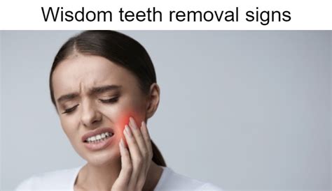 Wisdom Teeth Removal Signs The Dental Blogs