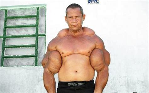 Watch Synthol Freak With Massive Muscles Get Owned By Much Smaller Arm