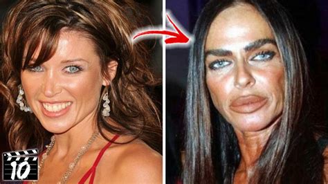 top 10 celebrities you won t recognize after plastic surgery part 3 youtube