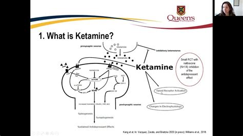 Ketamine In Treatment Resistant Depression An Evidence Based Approach