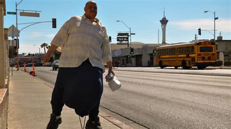 Tlc Gets To Know ‘the Man With The 132 Pound Scrotum