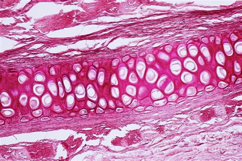 Human Cartilage And Bone Photograph By Choksawatdikorn Science Photo