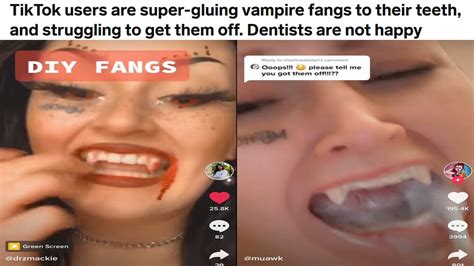 Rcringetopia Tiktokers Super Glue Fangs To Their Teeth And Cant