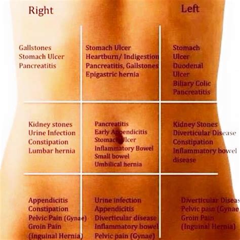 Stomach Pain Chart To Understand What Your Pain Tells You HealthInaSecond Com