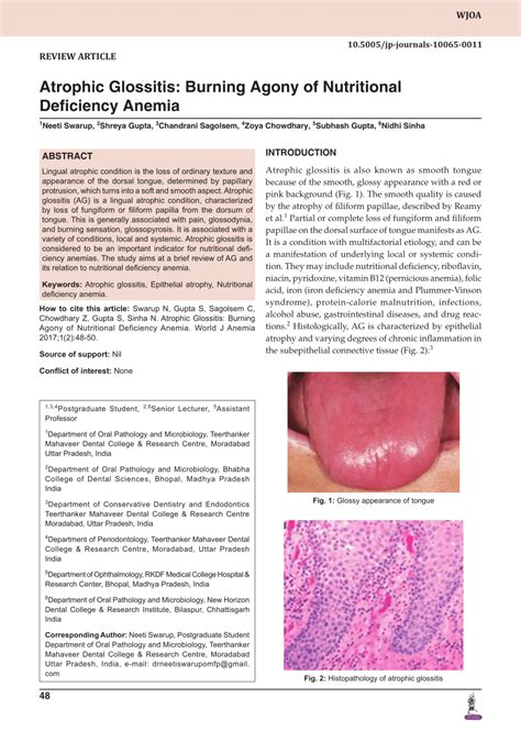 Pdf Atrophic Glossitis Burning Agony Of Nutritional Deficiency Anemia
