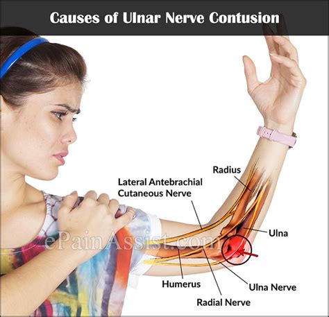 Elbow Contusion Treatment Human Body Anatomy