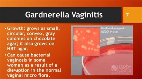 Bacterial Vaginosis Gardnerella Vaginitis