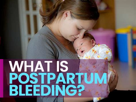 What Is Postpartum Bleeding Know About Acute Postpartum Haemorrhage And Its Treatments