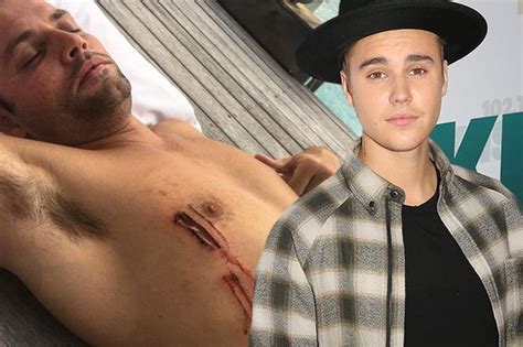 Justin Bieber Reveals Shark Attack Horror As His Friend Suffers Gruesome Injuries During Exotic