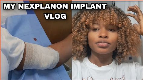 My Nexplanon Implant Birth Control Vlog Youtube