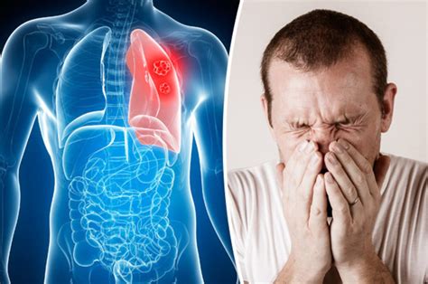 If you've been smoking for a long time, you may be at greater risk for developing lung cancer. Lung disease symptoms: Six common signs of cancer ...