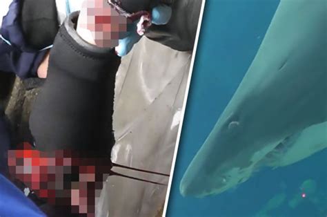 Shark Tears Divers Arm To Shreds In Graphic Video From Aquarium Daily Star