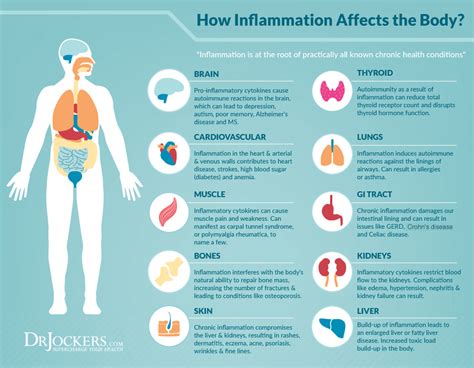 Inflammation 7 Signs You Shouldn’t Ignore
