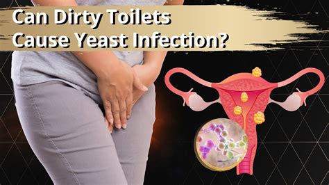 Do Dirty Toilets Cause Yeast Infection Radium Medical Aesthetics