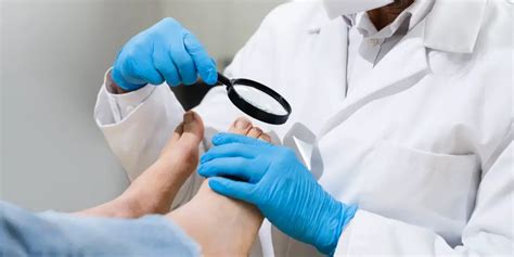 When To See A Doctor For An Ingrown Toenail Foot And Ankle Blog