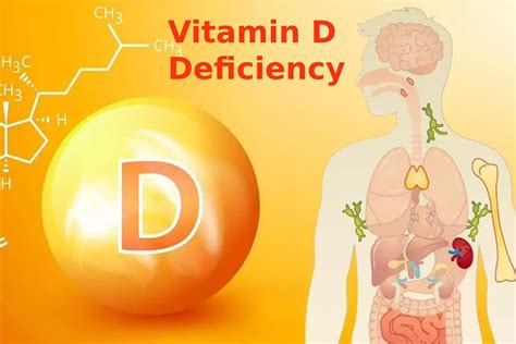 Vitamin D Deficiency Know The Symptoms And Treatment