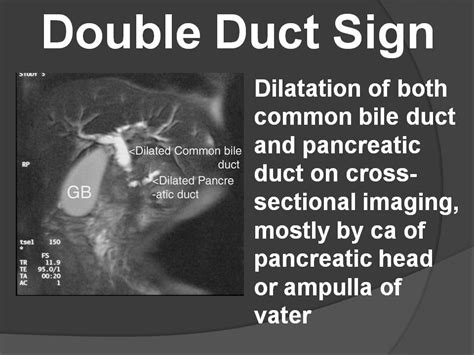 Double Duct Sign Radiology Classroom