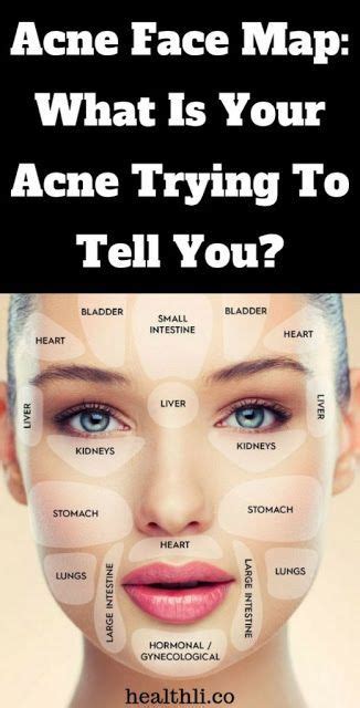 The Location Of Your Acne Can Tell A Lot About Your Health Face