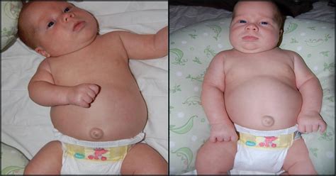 Why Does Your Newborn Have An Outie Belly Button