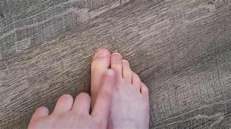 Why Are My Toes Red If Your Toes Are Red And Painful At The Top
