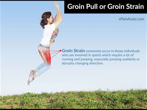 Groin Pull Or Groin Strainsymptomstreatmentrecoveryprognosisprevention