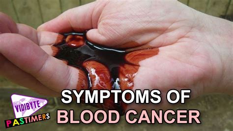 They are not bone cancers. What are the Symptoms of Blood Cancer || Health Tips - YouTube