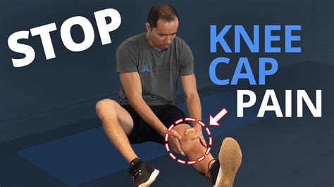 Treat Knee Cap Pain Patellar Mobilization Technique Youtube