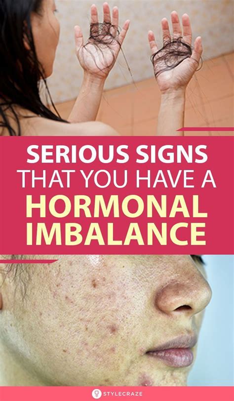 13 Signs That A Person May Have A Hormonal Imbalance Female Hormone