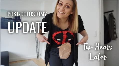 Post Colostomy Update 2 Years YouTube