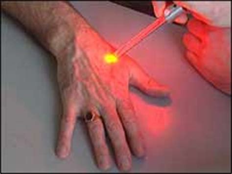 BBC NEWS | UK | England | Cornwall | New skin cancer ...