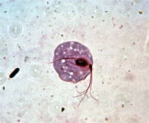 Trichomonad Parasite Protozoan Infection Britannica