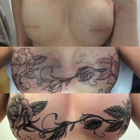 Ive Taken Back What Cancer Took Cancer Survivor Has Flowers Tattooed Across Chest To Reclaim