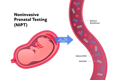 Μη επεμβατικός προγεννητικός έλεγχος Nipt Non Invasive Prenatal Test