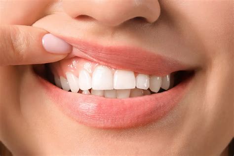 Receding Gums Causes Symptoms And Treatment Erdem Dental Clinic