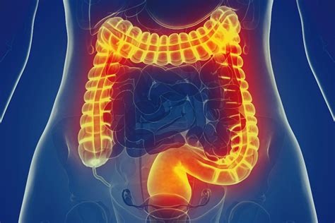 What Is The Best Treatment For Irritable Bowel Syndrome
