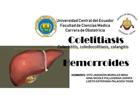 Colelitiasis Colecistitis Coledocolitiasis Colangitis Vito Morales