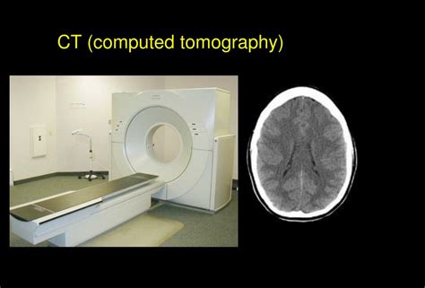 Ppt Principles Of Neuroimaging Powerpoint Presentation Free Download