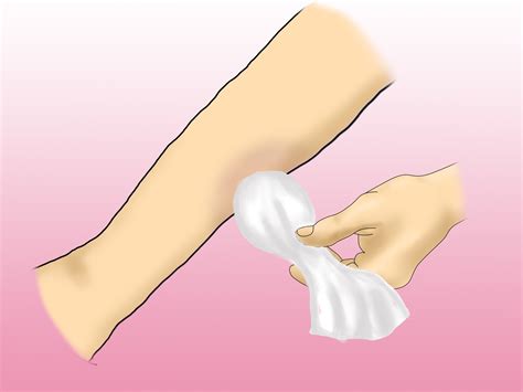 How to Get Rid of Bruises Easily: 4 Steps (with Pictures)