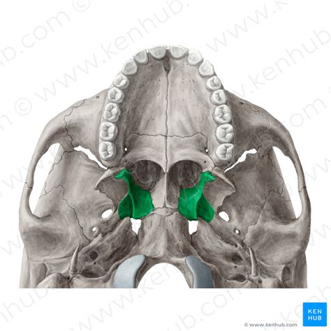 The pterygoid hamulus, a bony process of the the area and direct observation of the hamulus may medial pterygoid plate of the sphenoid bone, may be necessary. Medial plate of pterygoid process (Lamina medialis ...