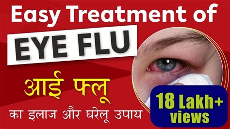 Eye Flu Treatment Conjunctivitis Cause Prevention And Treatment आई