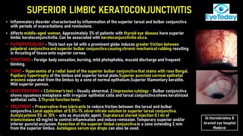Superior Limbic Kerato Conjunctivitis Eyetoday