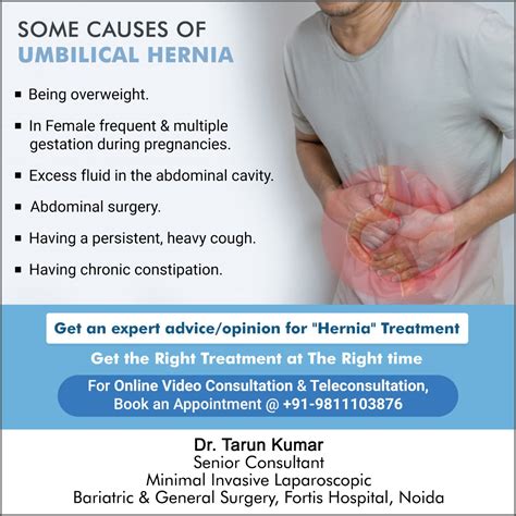 Umbilical Hernia Pictures